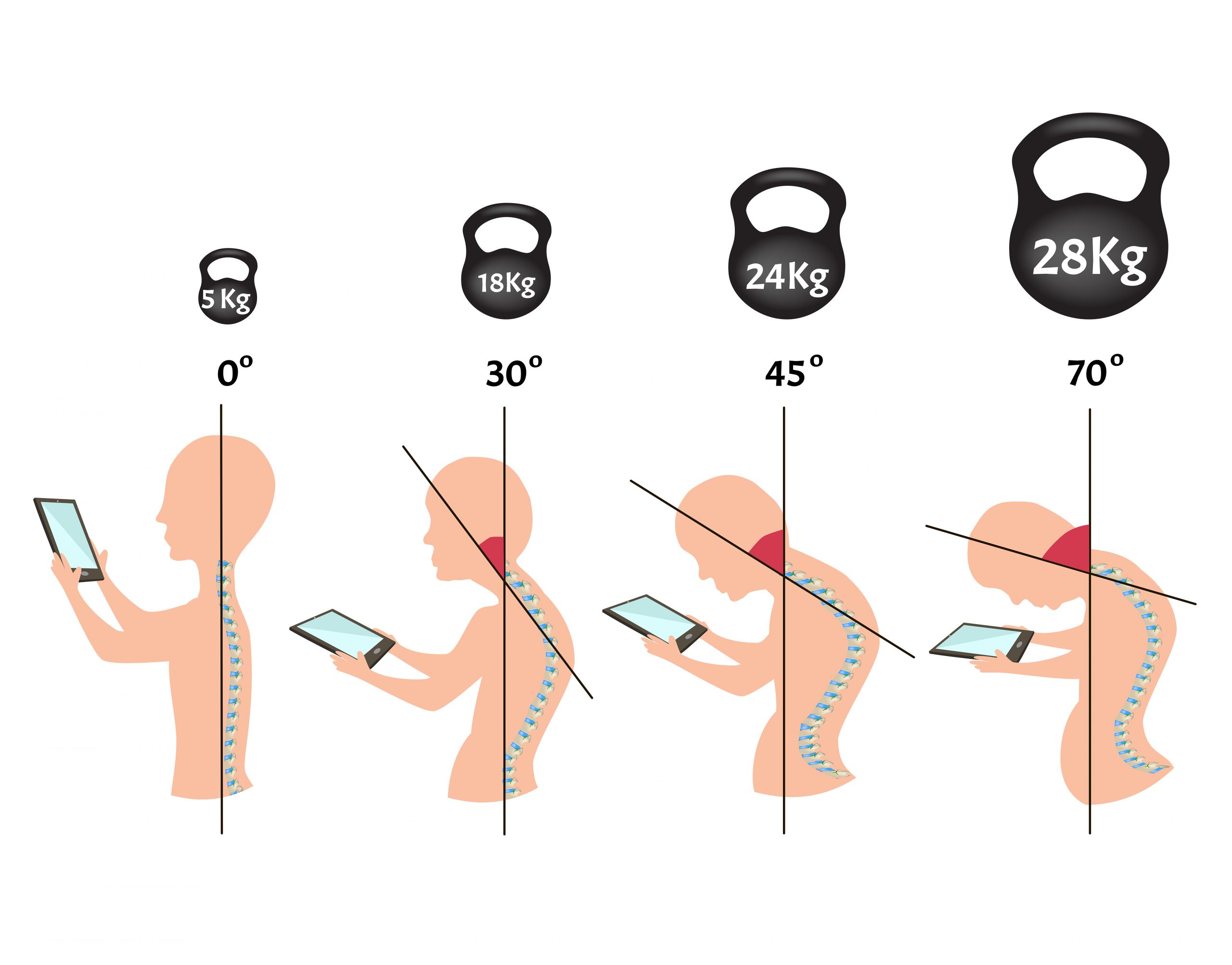 スマホ 首 改善